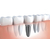 牙齿矫正、山南牙齿矫正、高英口腔缩略图1