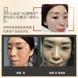 易美易爱多久去斑,迪庆易美易爱,微商代理(查看)