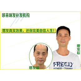 深圳织发*效果怎么样|织发*|哆来咪发真发套