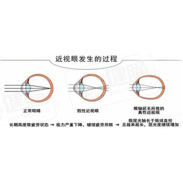 视力训练仪哪家好|广东视力训练仪|肇庆健瞳公司(多图)