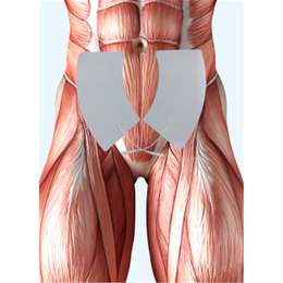 金华盆底肌电刺激电片_江苏泽康_盆底肌电刺激电片价格