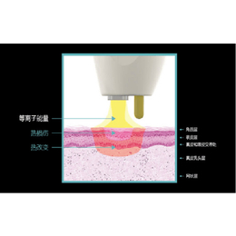 连云港离子刀_离子刀厂家_柏美(****商家)