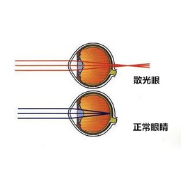湖州视力矫正、健瞳公司(图)、儿童视力矫正方法