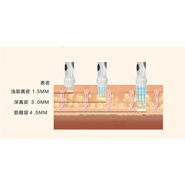 雷达冰雕多少钱一台|柏美实力商家|北京雷达冰雕