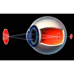 儿童视力矫正器、东莞视力矫正、健瞳公司(查看)