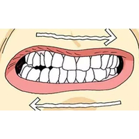 牙齿敏感是怎么了_淄博诺尔漫齿科怎么解决牙齿敏感