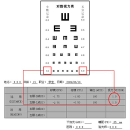 近视产品加盟_近视_健瞳公司