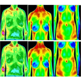 TC-8医用热成像测*缩略图