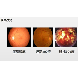 测视力-视力-南京护瞳