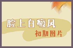 白癫峰(白癜风)在各个时期的治疗起到了什么作用