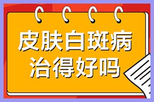 一般诊断皮肤是否患白有几种方法