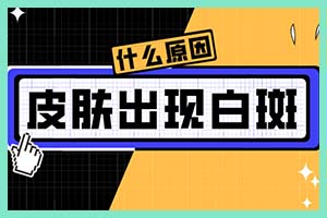 随便什么治皮肤病药物就能涂抹白癜风吗