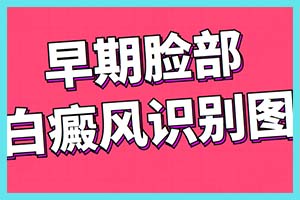 生活中治疗白癜风应当要注意什么