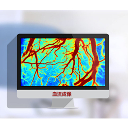 杭州血流仪-迅微光电公司-激光散斑血流仪