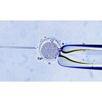 试管婴儿移植前胚胎宝宝是靠什么维持养分的呢？