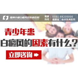 光泽那看白癜风较好