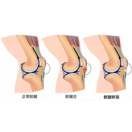 膝关节ct-南京膝关节-冷水医学科技