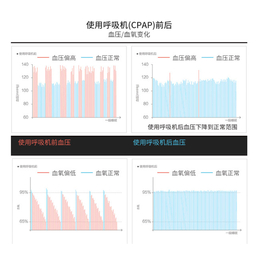 广州吉康(图)-进口呼吸机消毒-河源进口呼吸机